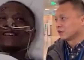 Médico chinês que mudou de cor devido à Covid-19 já recuperou tom de pele